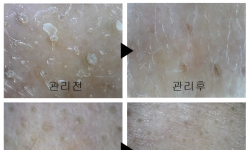 ���� �Ǻΰ���